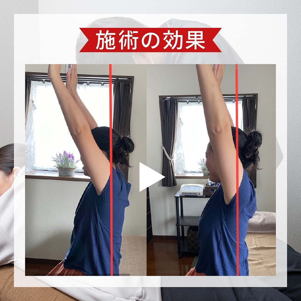 施術後の身体の動きをチェック